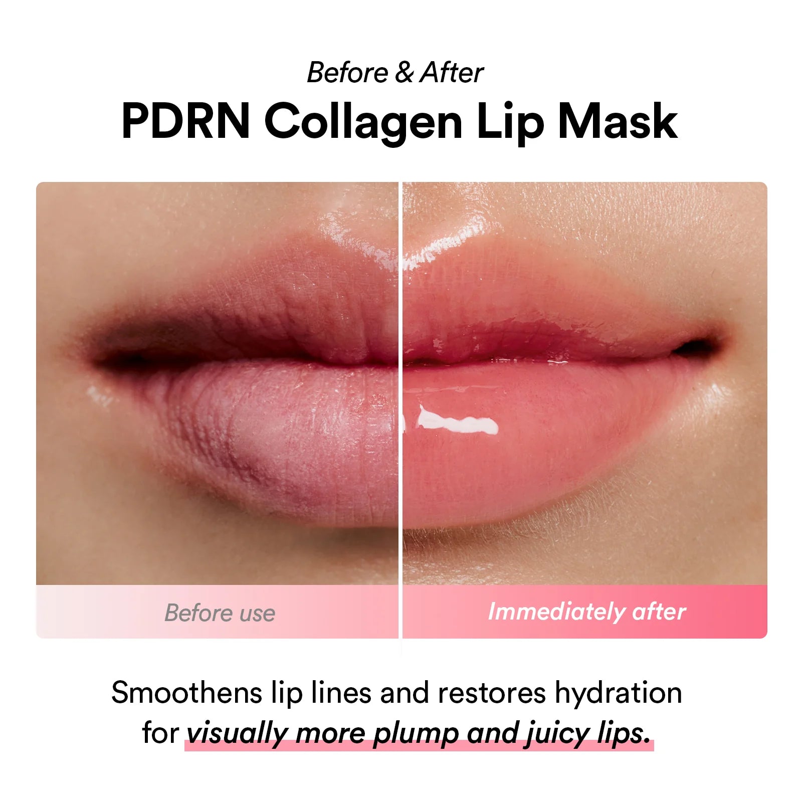 Abib - PDRN Collagen Lip Mask