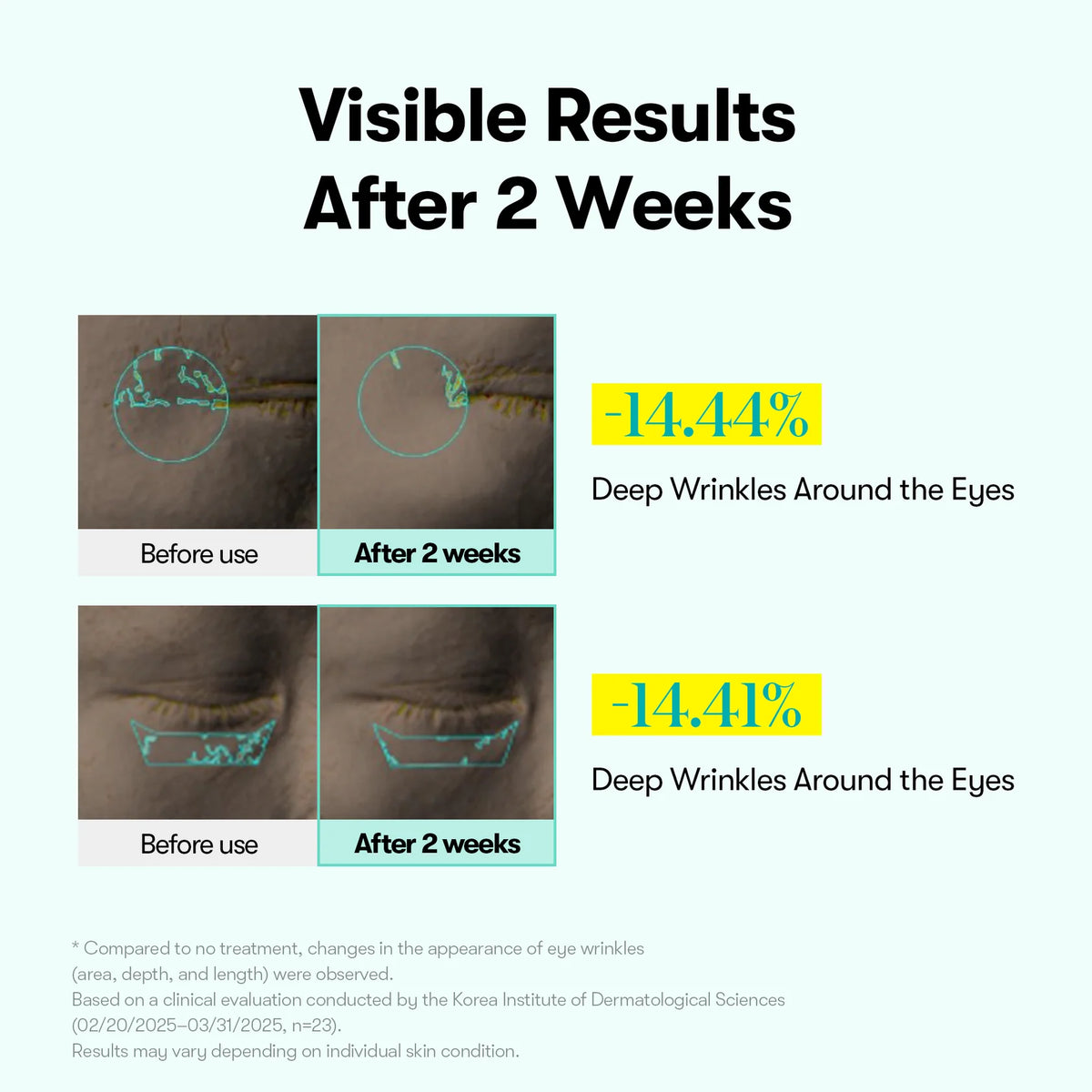 VT Cosmetics - PDRN Reedle Shot Firming Eye Cream